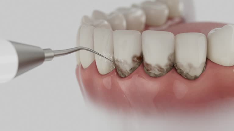 Trusted Invisalign Clear Aligners service in Lamoni, IA - Dentist Open Now